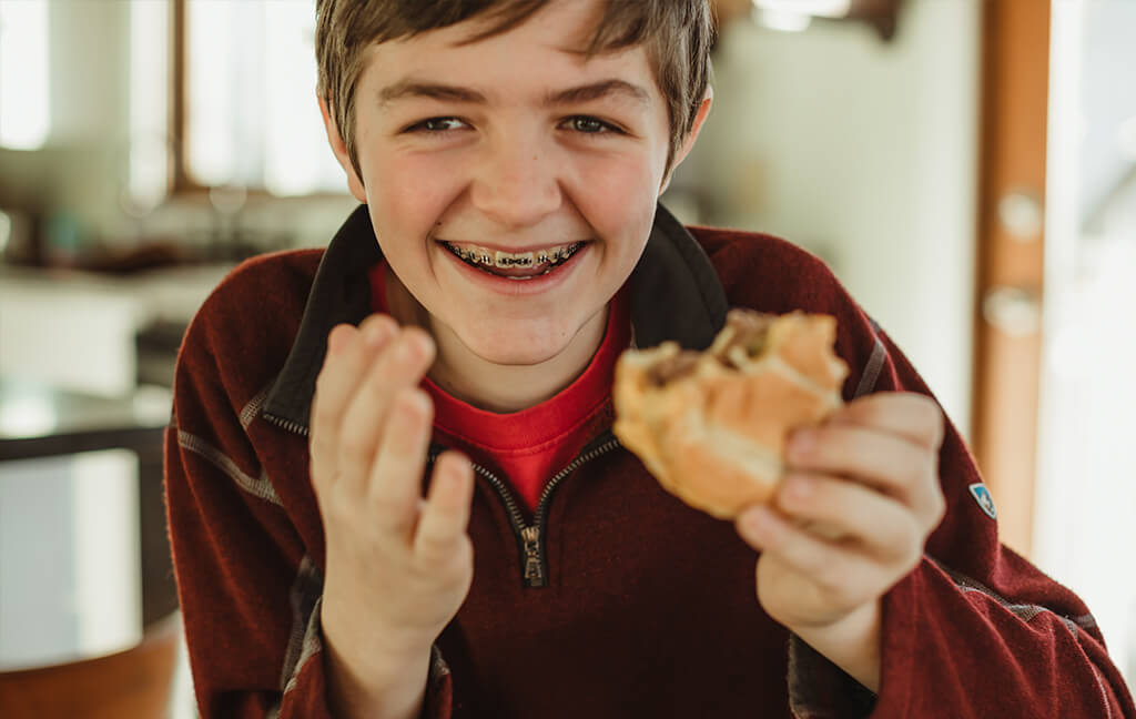 Boy smiling with braces holding a burger